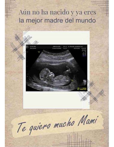 Caja ecografía mamá