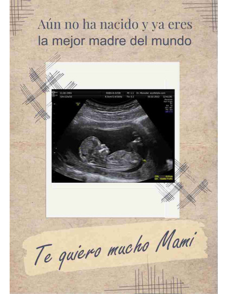 Caja ecografía mamá